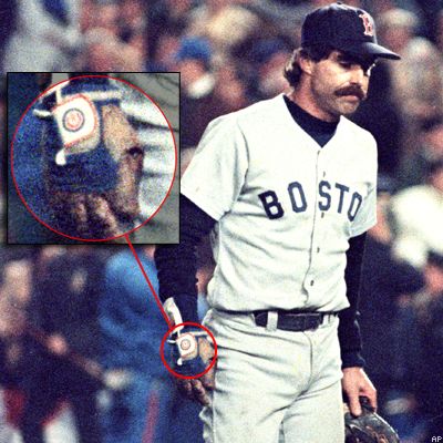 bill buckner ex cubs